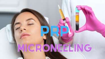 prp + microneedling